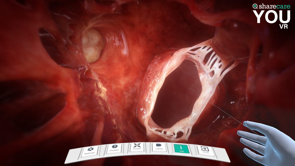 图片[3]VR玩吧-VR游戏破解下载网站-Quest 2 3 一体机游戏-Steam VR串流游戏-VR游戏资源汉化中文网站-Pico Neo3 4-Meta Quest 2 3-HTC VIVE-Oculus Rift-Valve Index-Pico VR-游戏下载中心Oculus Quest 游戏《器官解刨学VR》Sharecare YOU Anatomy VR（高速下载）VR玩吧-VR游戏破解下载网站-Quest 2 3 一体机游戏-Steam VR串流游戏-VR游戏资源汉化中文网站-Pico Neo3 4-Meta Quest 2 3-HTC VIVE-Oculus Rift-Valve Index-Pico VR-游戏下载中心VR玩吧【VRwanba.com】汉化VR游戏官网