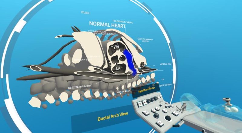 图片[3]VR玩吧-VR游戏破解下载网站-Quest 2 3 一体机游戏-Steam VR串流游戏-VR游戏资源汉化中文网站-Pico Neo3 4-Meta Quest 2 3-HTC VIVE-Oculus Rift-Valve Index-Pico VR-游戏下载中心Oculus Quest 游戏《心脏病医学VR》Fetal Heart VR 汉化版（高速下载）VR玩吧-VR游戏破解下载网站-Quest 2 3 一体机游戏-Steam VR串流游戏-VR游戏资源汉化中文网站-Pico Neo3 4-Meta Quest 2 3-HTC VIVE-Oculus Rift-Valve Index-Pico VR-游戏下载中心VR玩吧【VRwanba.com】汉化VR游戏官网