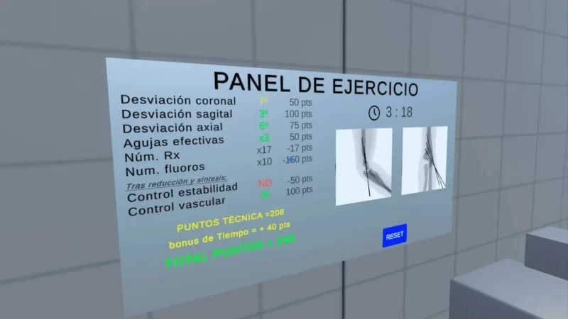 图片[4]VR玩吧-VR游戏破解下载网站-Quest 2 3 一体机游戏-Steam VR串流游戏-VR游戏资源汉化中文网站-Pico Neo3 4-Meta Quest 2 3-HTC VIVE-Oculus Rift-Valve Index-Pico VR-游戏下载中心Meta Quest 游戏《X射线模拟》VR Fix SupraVR玩吧-VR游戏破解下载网站-Quest 2 3 一体机游戏-Steam VR串流游戏-VR游戏资源汉化中文网站-Pico Neo3 4-Meta Quest 2 3-HTC VIVE-Oculus Rift-Valve Index-Pico VR-游戏下载中心VR玩吧【VRwanba.com】汉化VR游戏官网